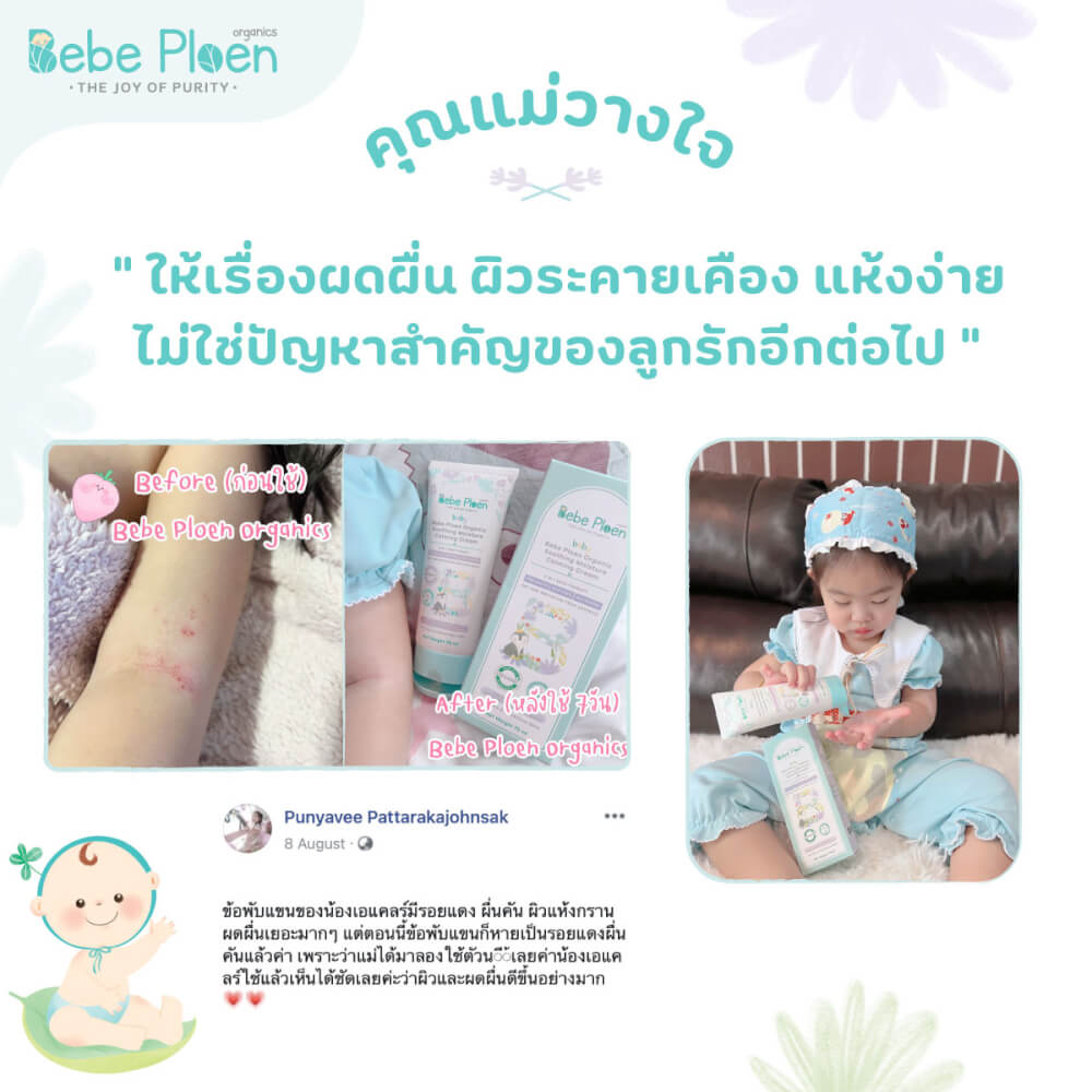 ครีมแก้ผิวแห้งผดผื่น เบเบ้ เพลิน ออร์แกนิค