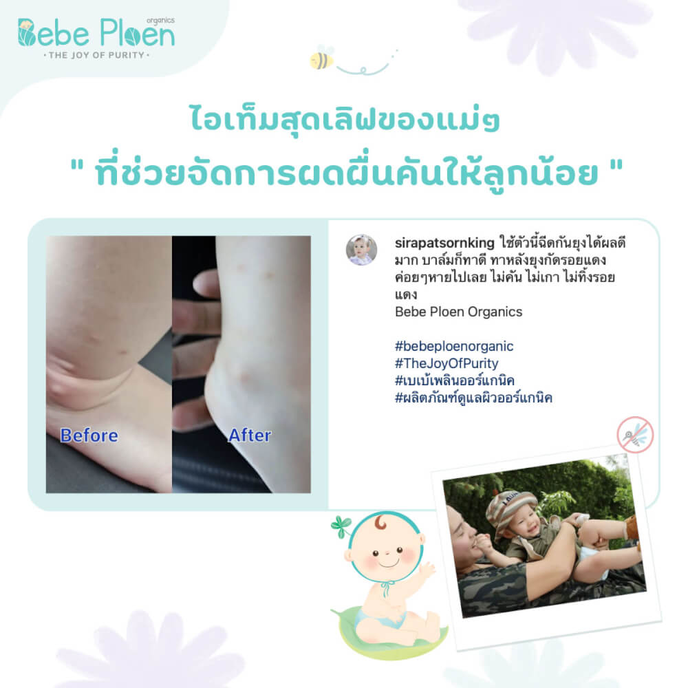 บาล์มทาหลังยุงและแมลงกัดต่อย เบเบ้ เพลินออร์แกนิค