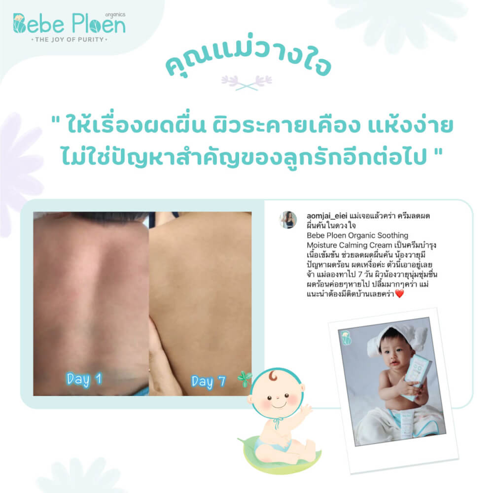 ครีมแก้ผิวแห้งผดผื่น เบเบ้ เพลิน ออร์แกนิค