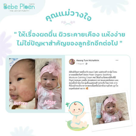 ครีมแก้ผิวแห้งผดผื่น เบเบ้ เพลิน ออร์แกนิค_7