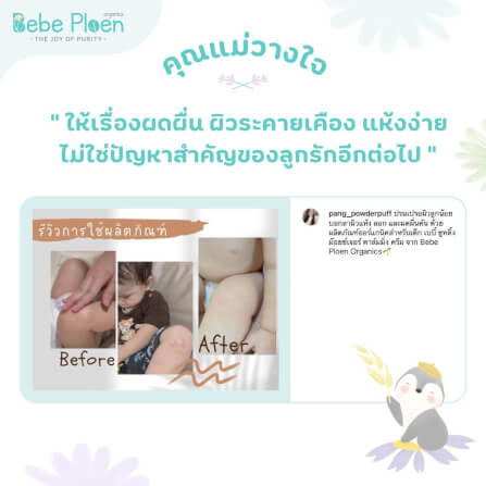 ครีมแก้ผิวแห้งผดผื่น เบเบ้ เพลิน ออร์แกนิค_8