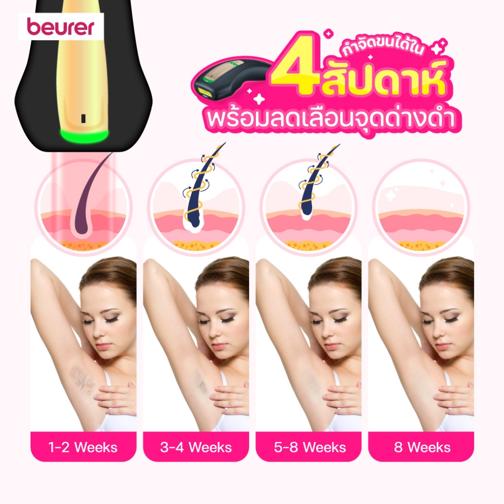 เครื่องกำจัดขนเลเซอร์กำจัดขน Beurer รุ่น IPL 5800 สีดำ_3