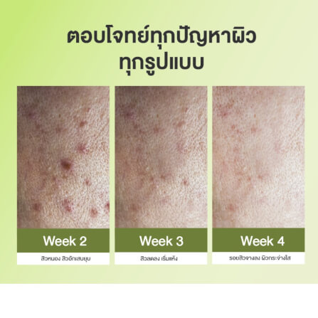 บาลานส์ แอสต้าแซนธิน พลัส 30 แคปซูล_5
