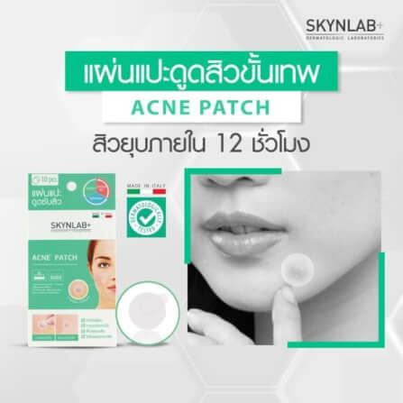 แผ่นซับสิวสกินแล็บ แอคเน่แพทช์ ขนาด 0.08 มม. จำนวน 10 แผ่น_3
